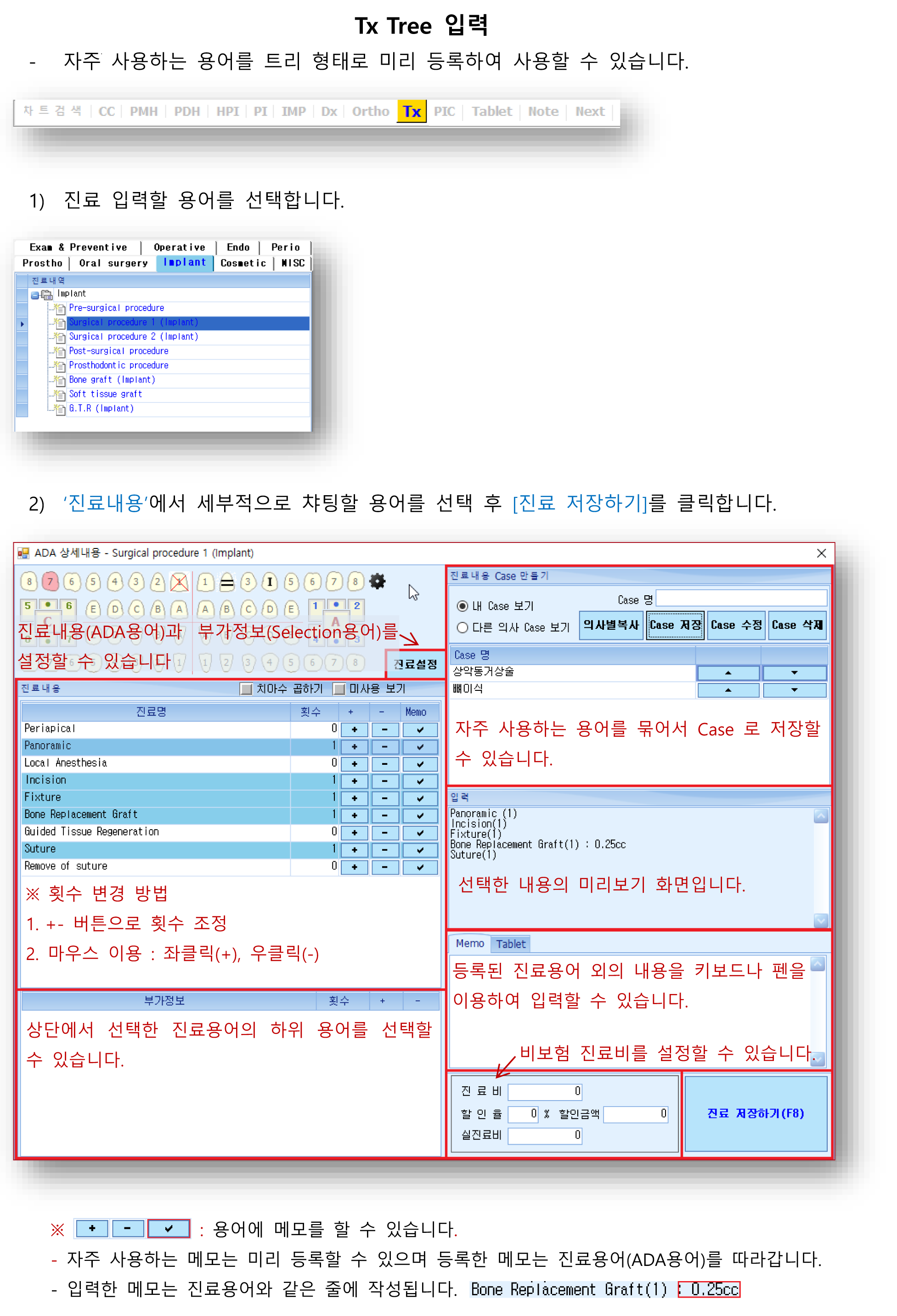 Tx Tree 입력.png