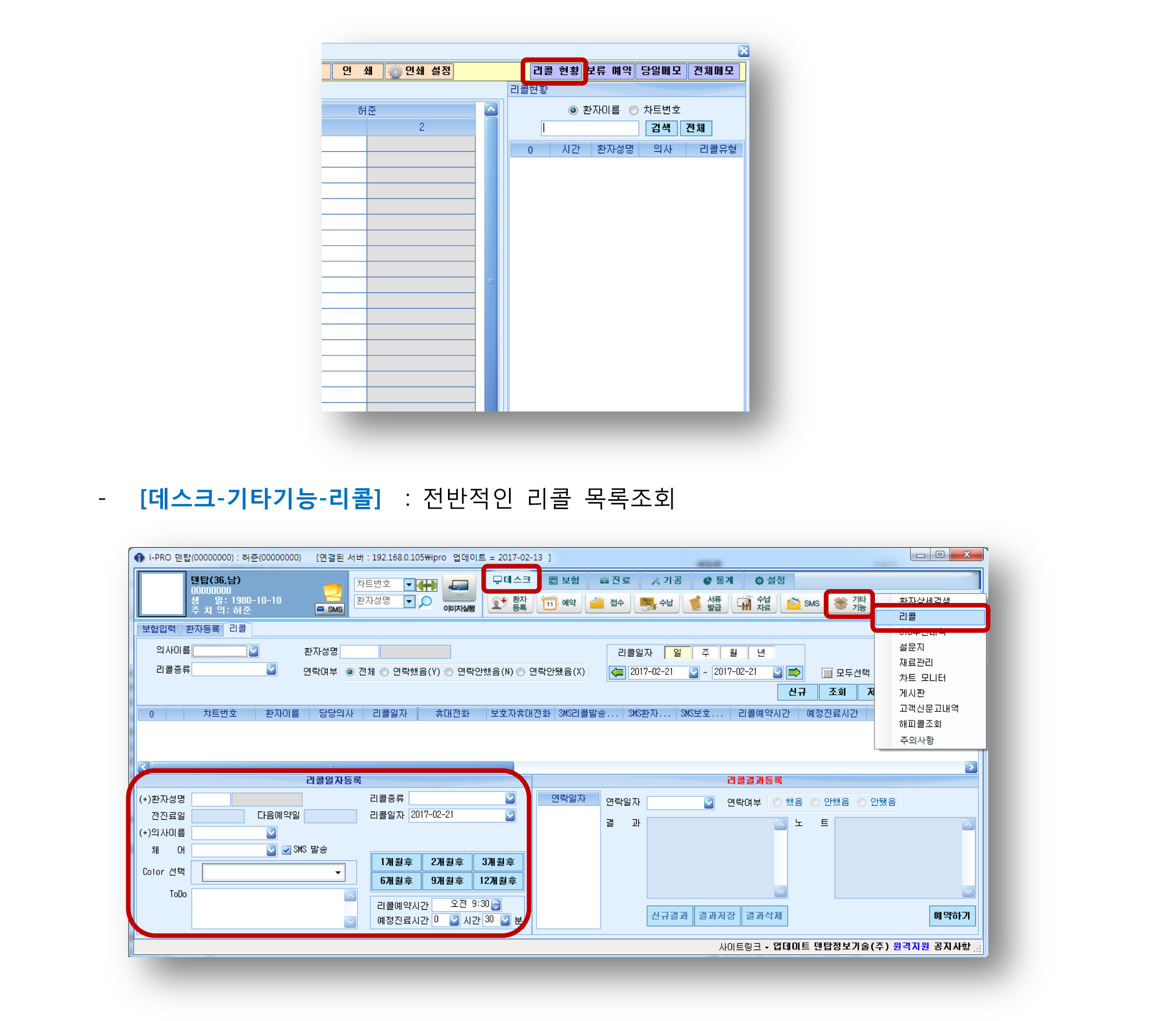 5 리콜-3.png