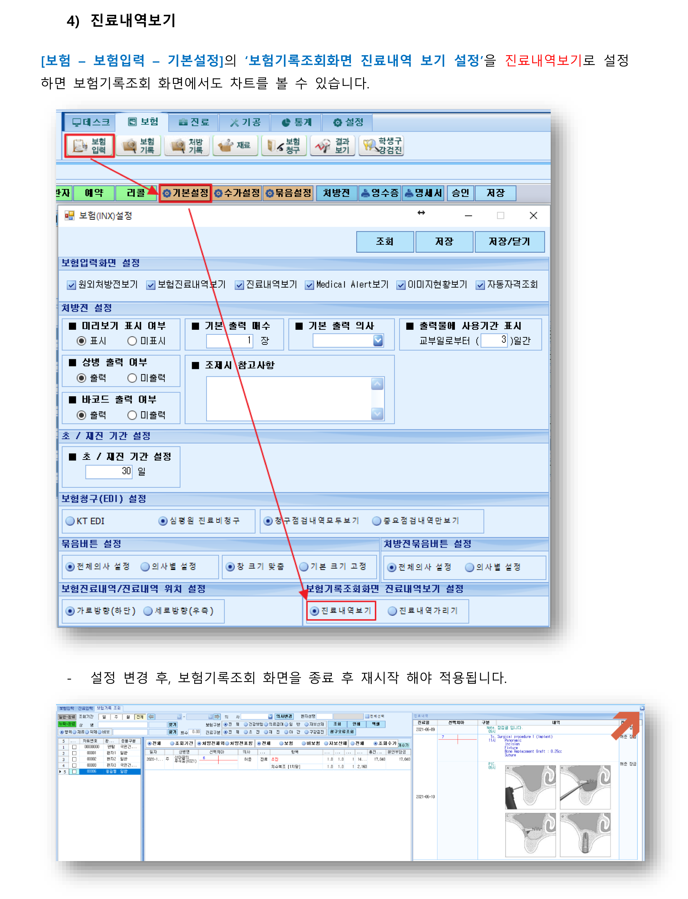 보험기록조회.png