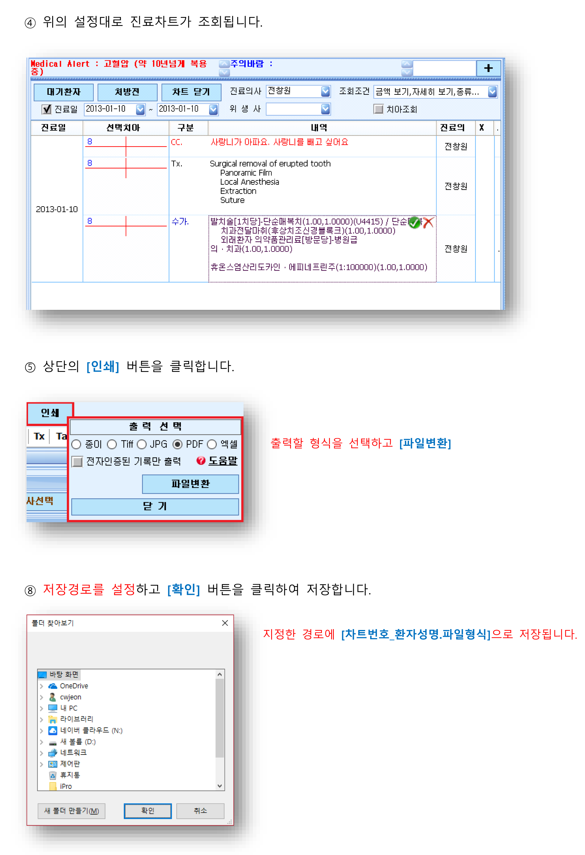 진료기록부 인쇄하기-2.png