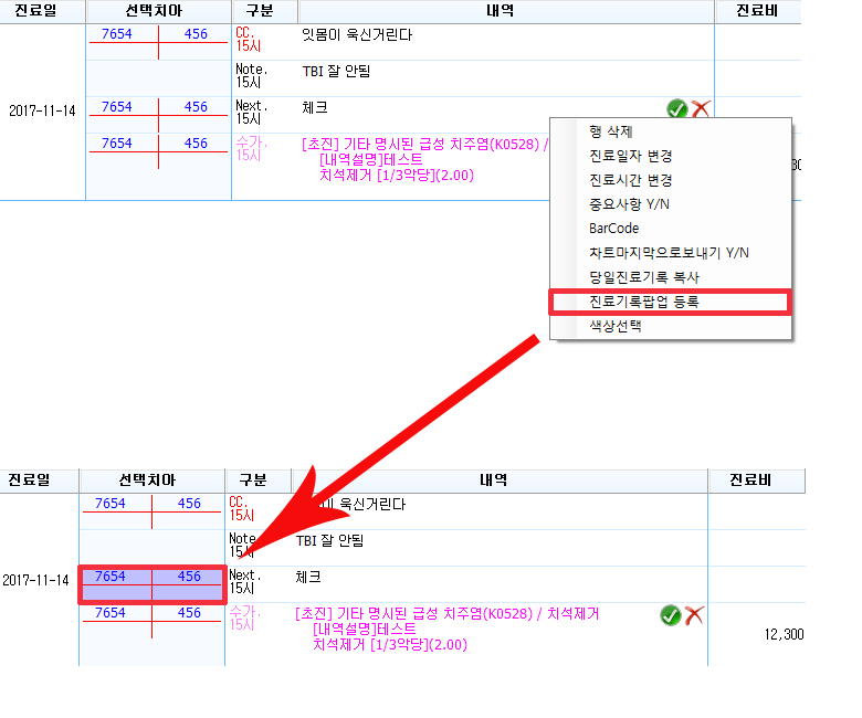 진료기록팝업등록여부.jpg