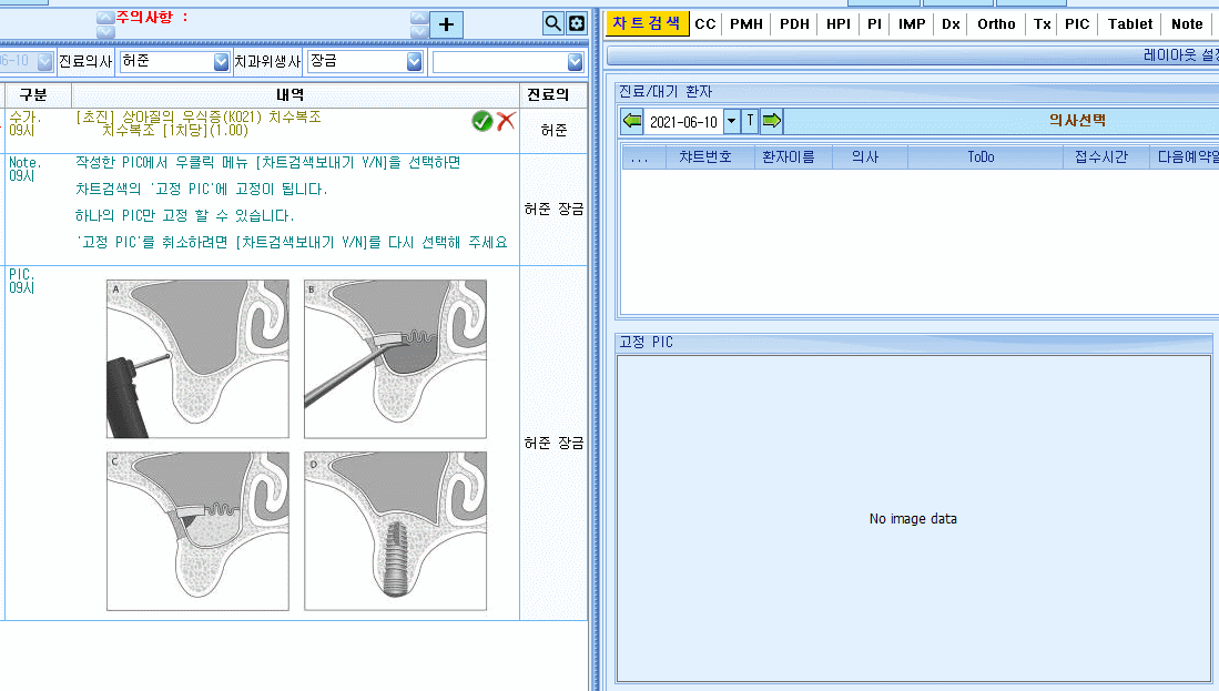 차트검색보내기.gif