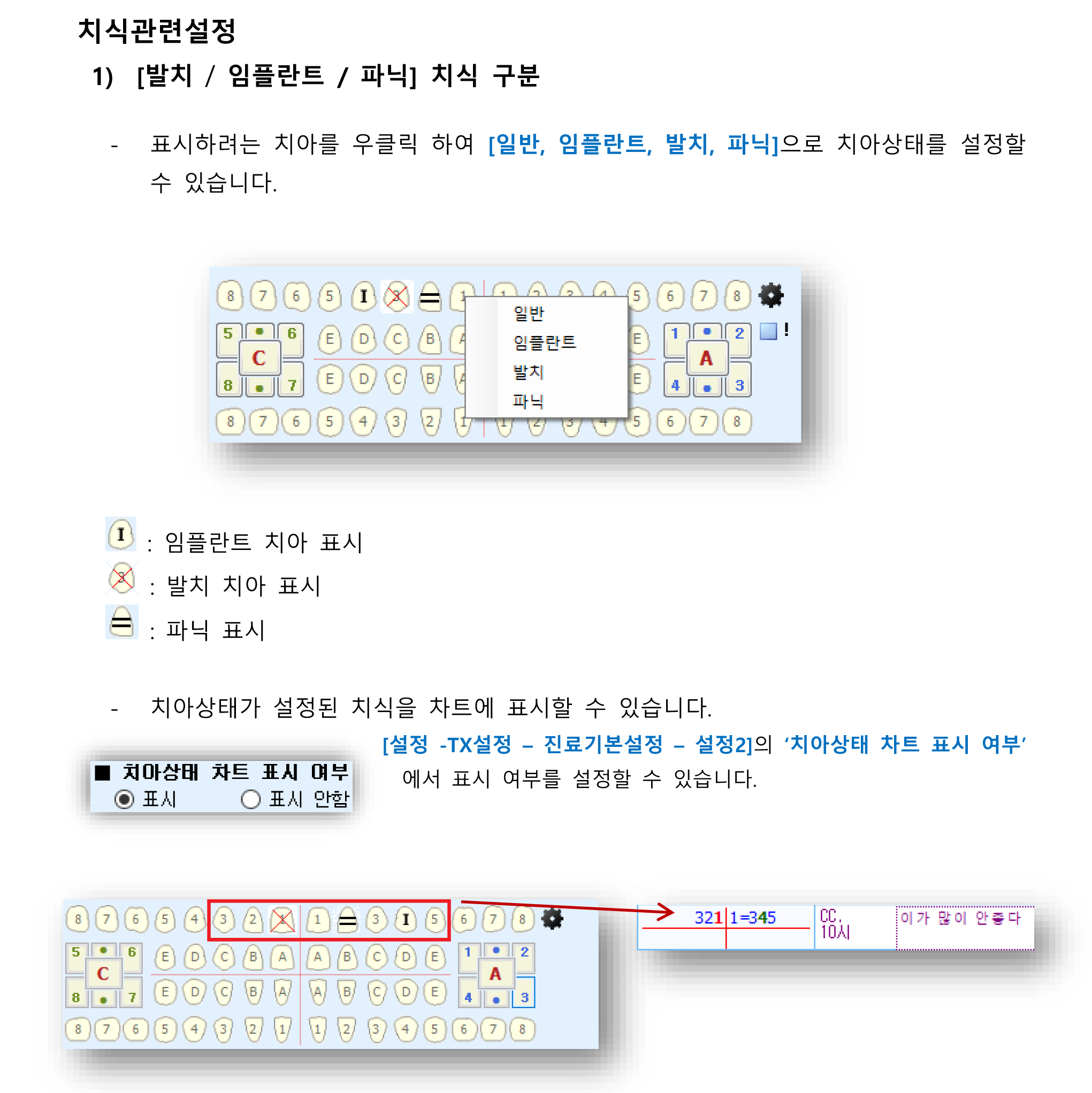 치식관련설정-1.png